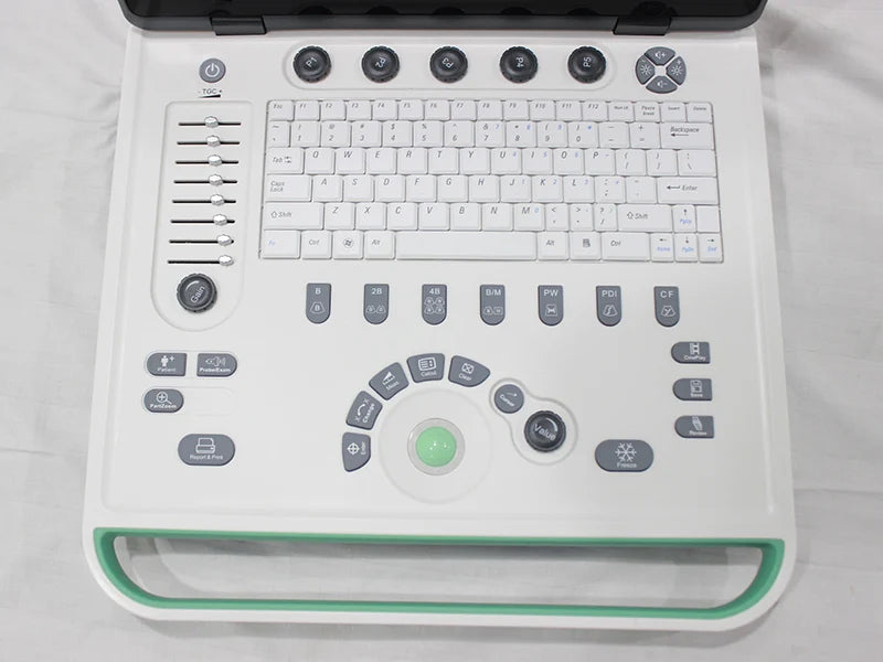 Suresult C5Pre Portable Color Doppler Ultrasound Machine High Performance Medical Imaging Device
