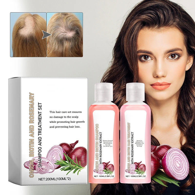 Onion Biotin Rosemary Shampoo Care Set Shampoo Conditioner For All Hair Types Hair Care Shampoo Treatment Silicone Free Shampoo