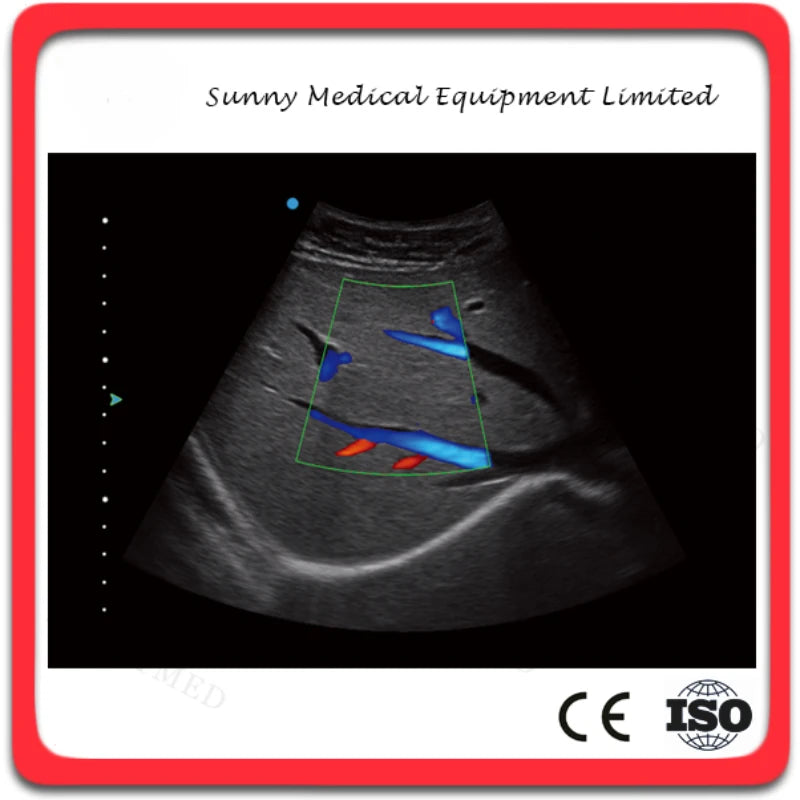 SYA-2300 Enhanced USG Portable 4D Laptop Ultrasound with High Image Performance