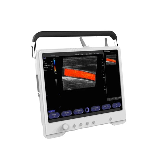 SY-A012 High Performance Color Doppler Ultrasonic Diagnostic Equipment