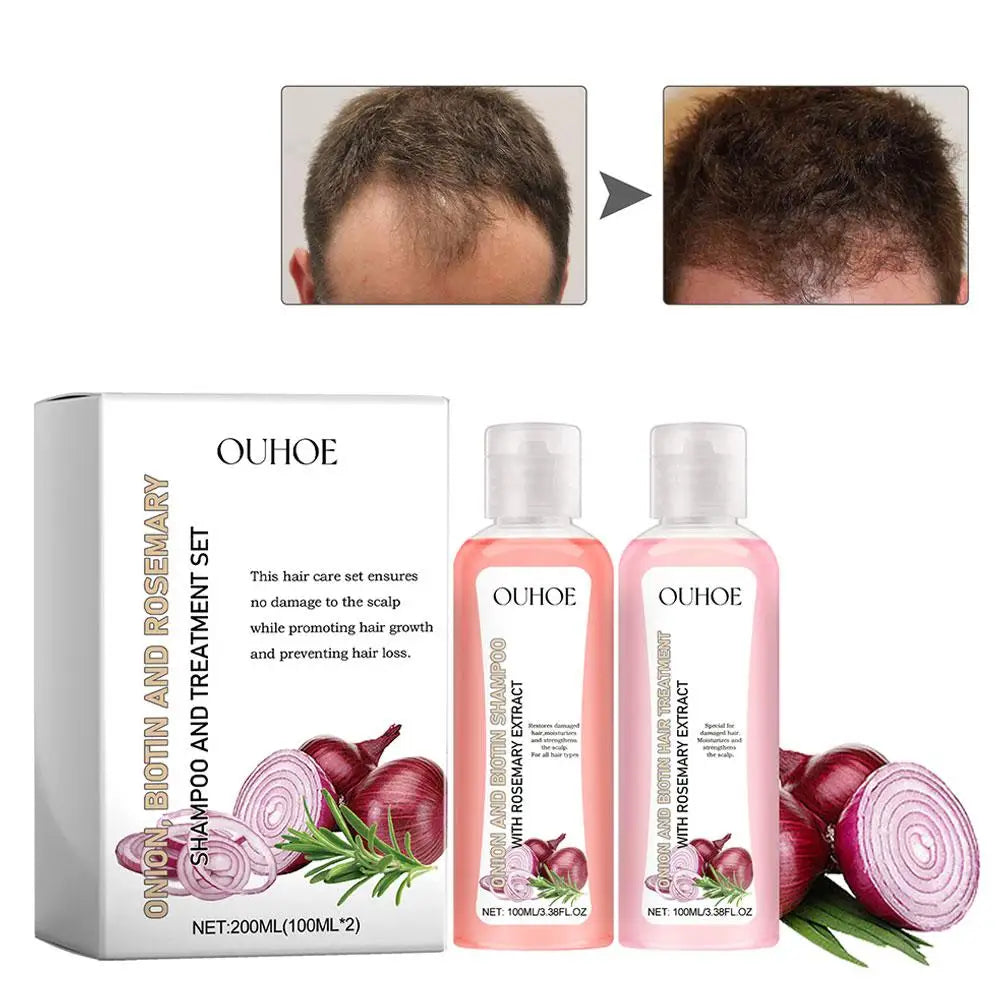 2 Bottles/Set Onion Biotin And Rosemary Shampoo+Conditioner Hair Treatment Anti Hair Loss For All Hair Types Hair Care