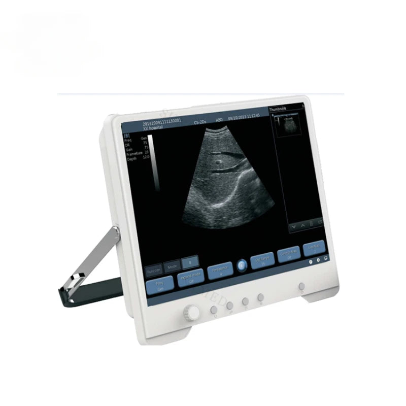 SY-A012 High Performance Color Doppler Ultrasonic Diagnostic Equipment